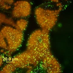USGS_Cyanobacteria_13%20Nutrient%20Series%20Iowa%20Nutrient%20Reduction%20Strategy%20Microsystis USGS_Cyanobacteria_13%20Nutrient%20Series%20Iowa%20Nutrient%20Reduction%20Strategy%20Microsystis