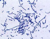 1655326537478 Webnewsanthrax