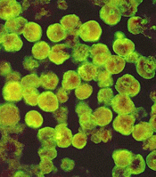 1655326688339 Braineating